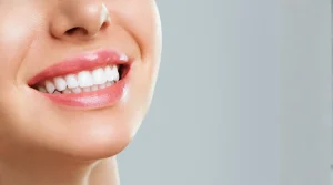 a woman showing white teeth